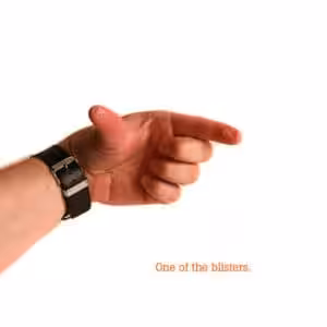 Alternative view of Branded - Painless Card Blister on Finger - Gimmicks